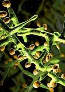 Un hongo bajo un microscopio