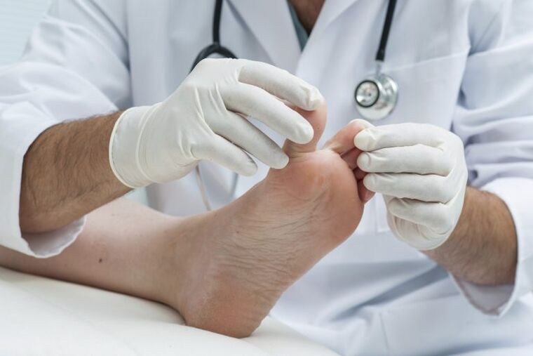 El examen del médico por la presencia de la micosis