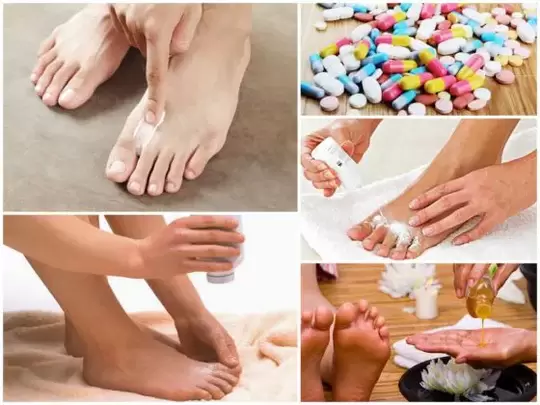 Maneras de tratar los hongos entre los dedos de los pies.