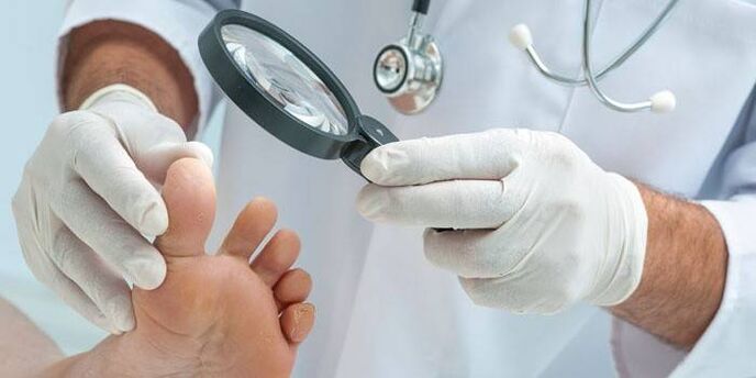 El médico examina los pies en busca de hongos entre los dedos.