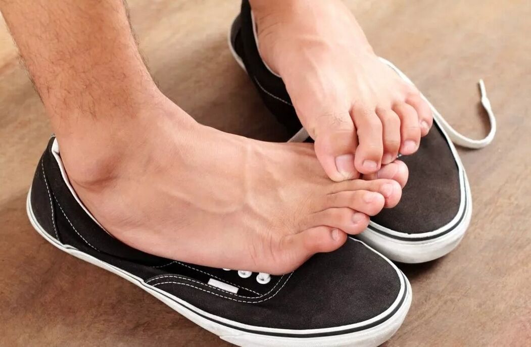picazón en los pies debido a hongos entre los dedos